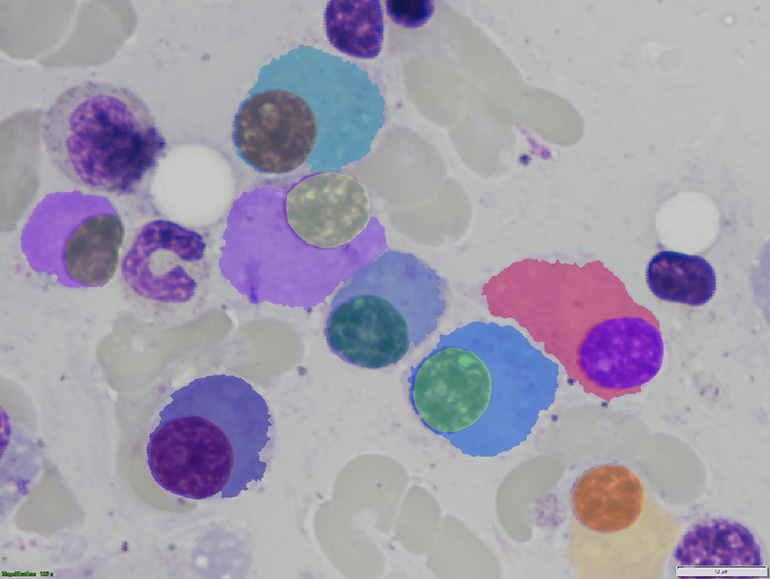 Original image (upper) and same image with nucleus and cytoplasm instance labels overlapped using different colors (bottom).